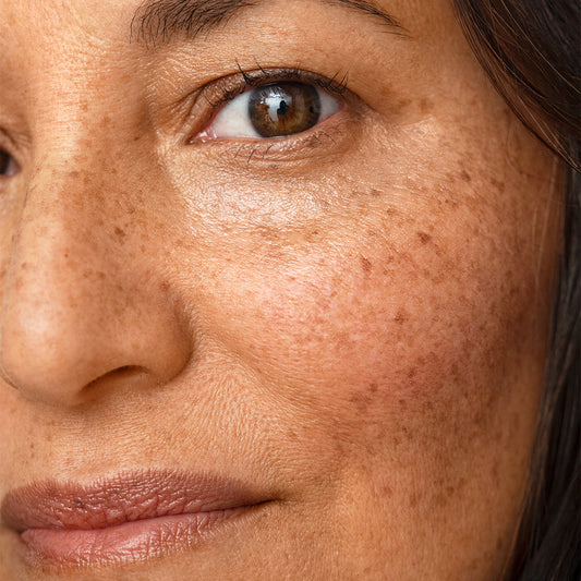How to Tell What Skin Type You Have and Why it Matters